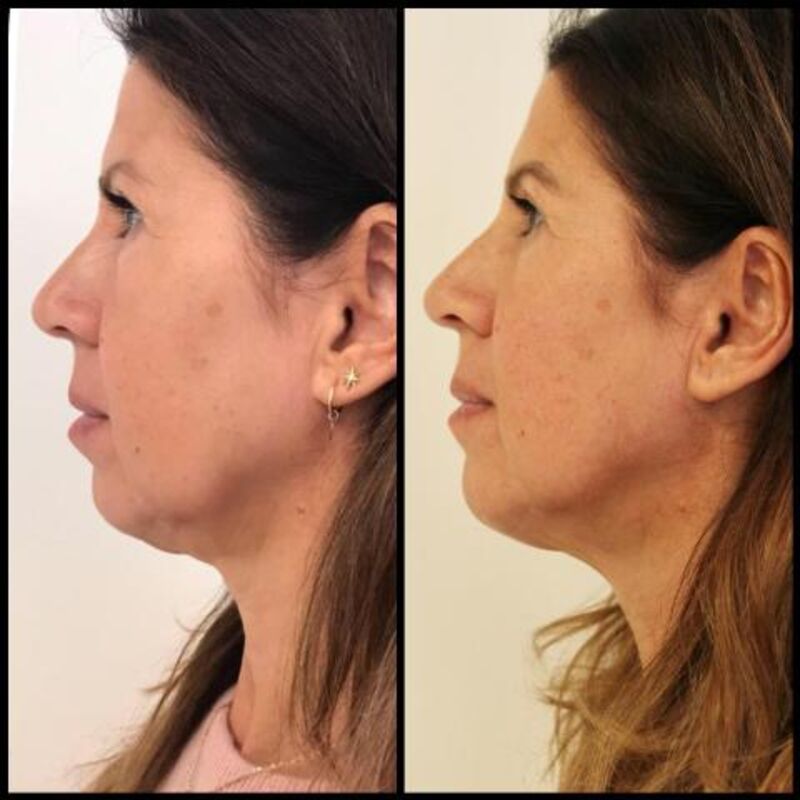 Isa Hoes Jaren Jonger