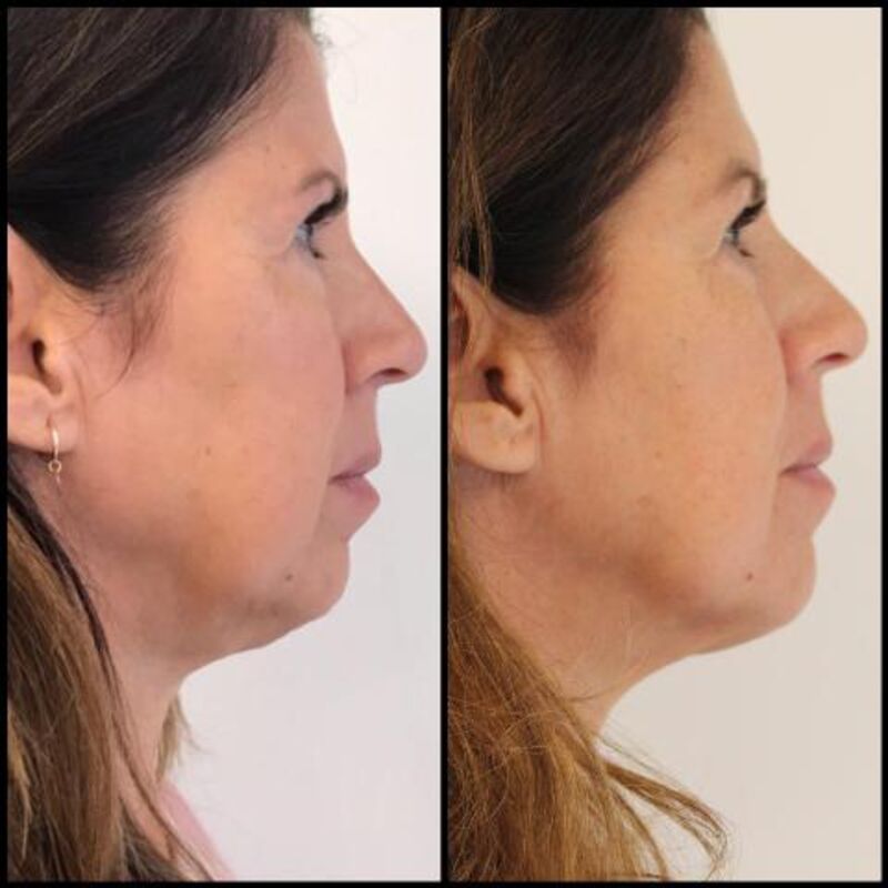 Isa Hoes Jaren Jonger