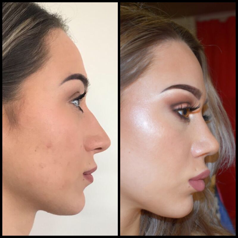 Rosa, wat ben ik blij met mijn neus!