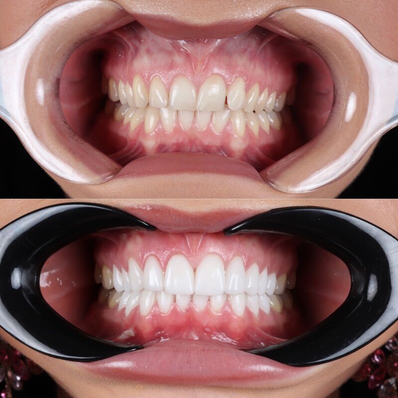 Adrianna een nieuwe lach