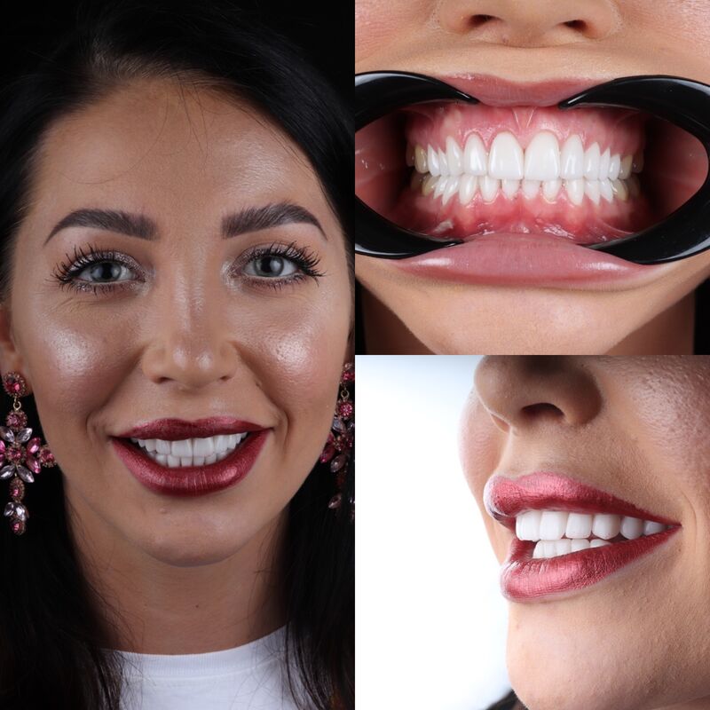 Adrianna een nieuwe lach