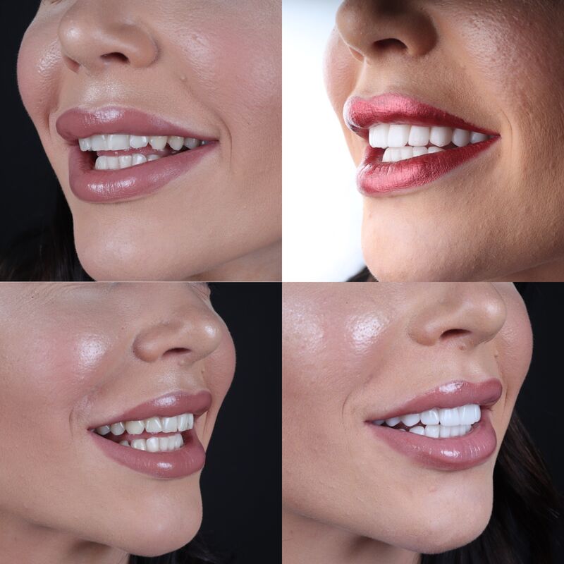 Adrianna een nieuwe lach