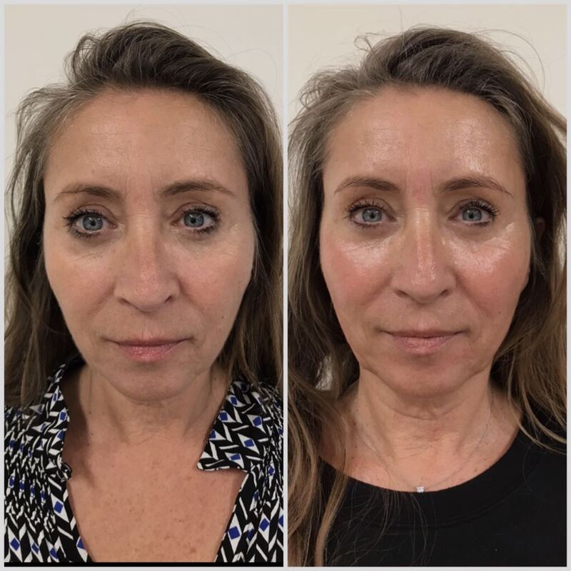 Jullie staan altijd klaar voor me, bedankt!