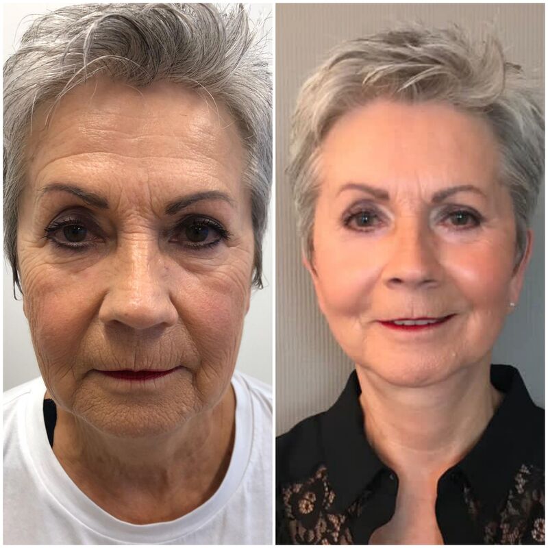 Verbluffende facelift Turkije