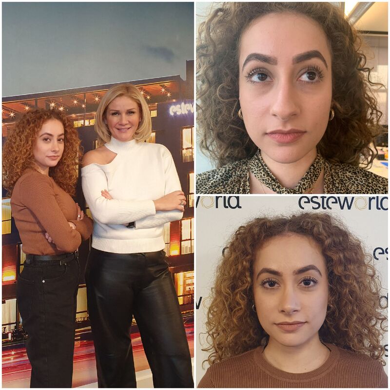 Betul super blij met neuscorrectie