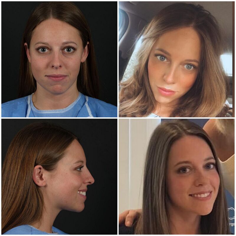 Erg meegevallen,super tevreden!