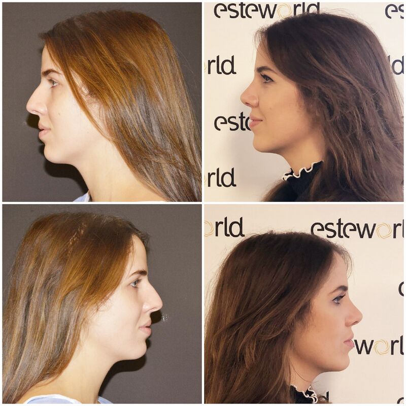 Niet twijfelen, Esteworld is geweldig! 