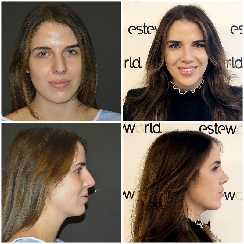 Niet twijfelen, Esteworld is geweldig! 