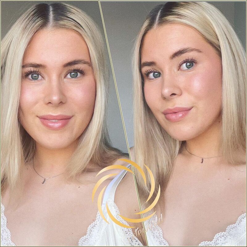 Beste keuze ooit geweest! Blij met mijn Neus!