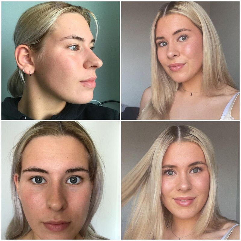 Beste keuze ooit geweest! Blij met mijn Neus!