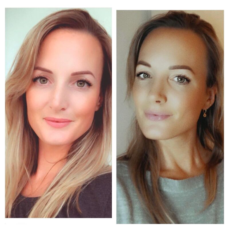 Esteworld bedankt voor mijn nieuwe neus!