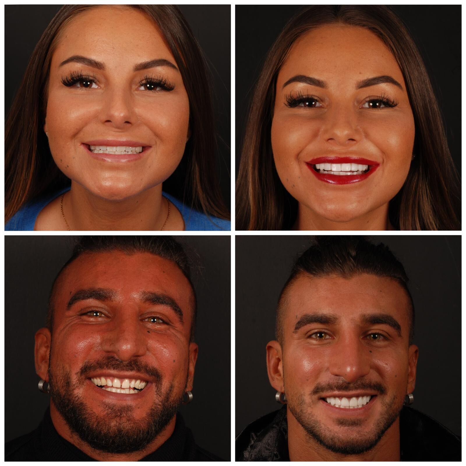 Hollywoodsmile Turkije