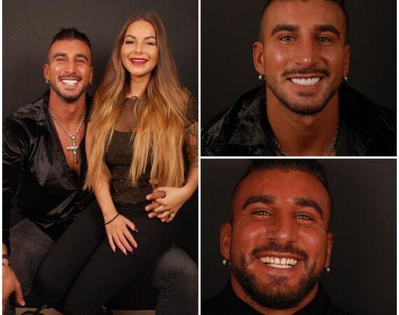 Hollywoodsmile Turkije